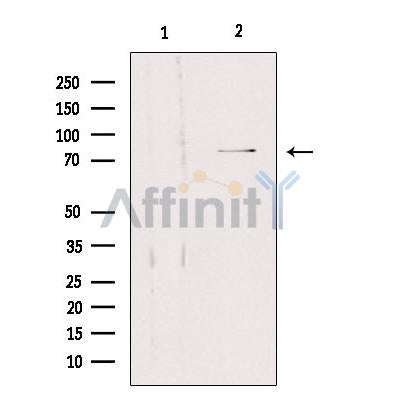 SLC5A3 Antibody – Figure 1 of 1
