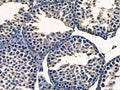 TAS1R3 Antibody – Figure 1 of 1