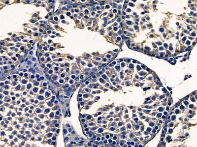 TAS1R3 Antibody – Figure 1 of 1