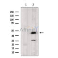OXER1 Antibody – Figure 1 of 1