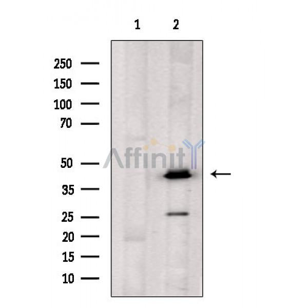 OXER1 Antibody – Figure 1 of 1