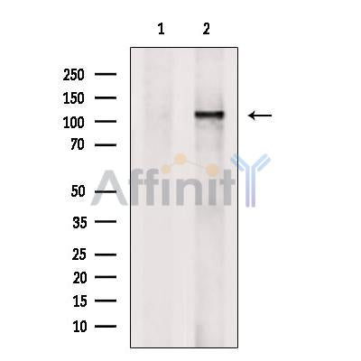 SirT1 Antibody – Figure 1 of 50