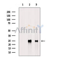 IL6 Antibody – Figure 1 of 116