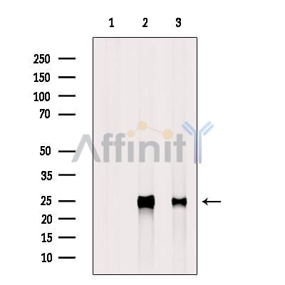 IL6 Antibody