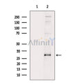 p27 Kip1 Antibody – Figure 1 of 3