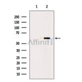 G6PD Antibody – Figure 1 of 5