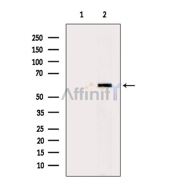 G6PD Antibody – Figure 1 of 5