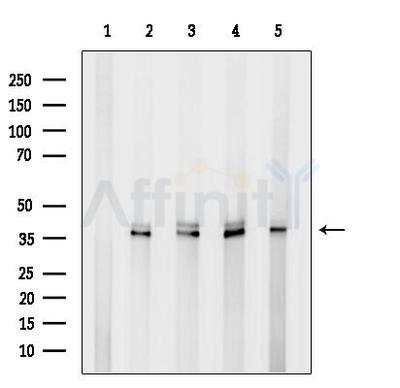 Western blot analysis of lysates from various samples, using EEF1D Antibody. Lane 1: Rat liver, treated with blocking peptide; Lane 2: Rat liver; Lane 3: K562; Lane 4: C6 cells; Lane 5: VERO cells.