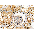 ENaC gamma Antibody – Figure 1 of 4