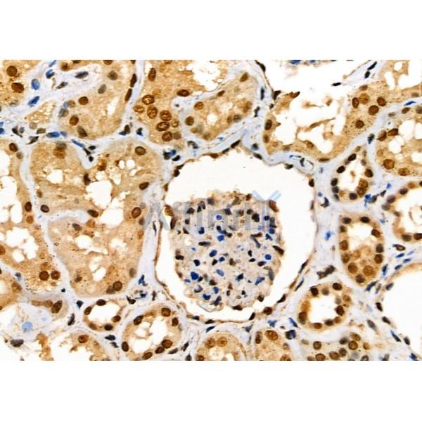 ENaC gamma Antibody – Figure 1 of 4
