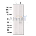 Cytochrome c Oxidase 3 Antibody – Figure 1 of 4