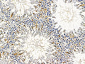 CHAC1 Antibody – Figure 1 of 3