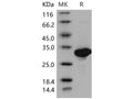 Recombinant Mouse Carbonic Anhydrase II/CA2 Protein (His Tag) – Figure 1 of 2