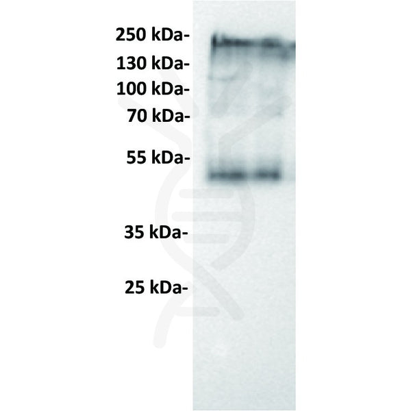 Anti-CEACAM5 antibody(1B5), IgG1 Chimeric mAb – Figure 1 of 1