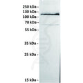 Anti-ROR1 antibody(151A5), IgG1 Chimeric mAb – Figure 1 of 1