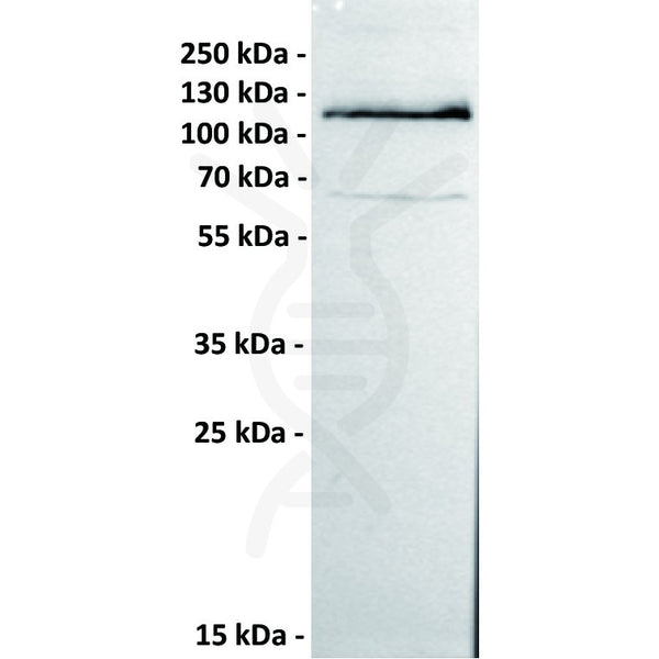 Anti-ROR1 antibody(151A5), IgG1 Chimeric mAb – Figure 1 of 1
