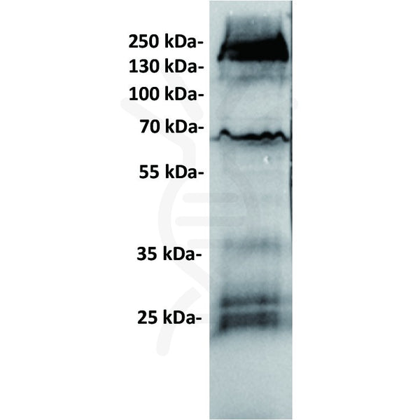 Anti-GUCY2C antibody(6E3), IgG1 Chimeric mAb – Figure 1 of 1