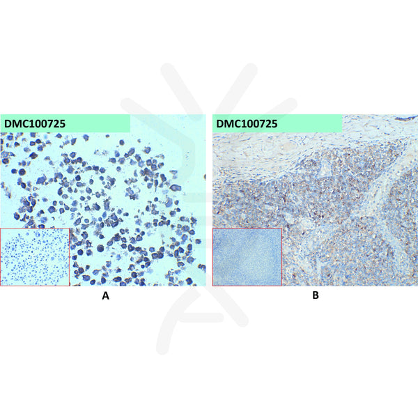 Anti-CD45 antibody(7E1), IgG1 Chimeric mAb – Figure 1 of 1