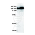 Anti-CD19 antibody(11B2), IgG1 Chimeric mAb – Figure 1 of 1