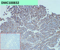 Anti-ADAM9 antibody(45G10), IgG1 Chimeric mAb – Figure 1 of 1