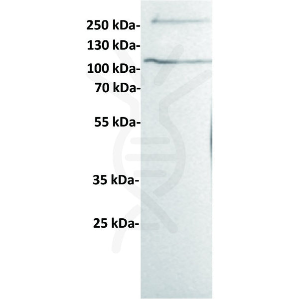 Anti-Her3 antibody(13D3), Rabbit mAb – Figure 1 of 1