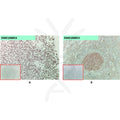 Anti-FCRL5 antibody(1A11), Rabbit mAb – Figure 1 of 1