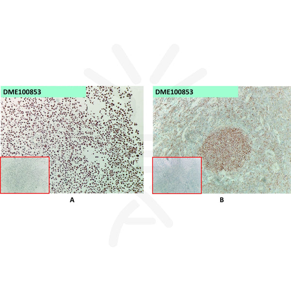 Anti-FCRL5 antibody(1A11), Rabbit mAb – Figure 1 of 1