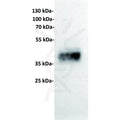 Anti-TROP2 antibody(17A11), Rabbit mAb – Figure 1 of 1