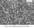 ACTA1 CRISPR Knockout 293T Cell Line | Applied Biological Materials (abm)