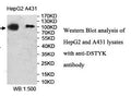 Anti-DSTYK Antibody – Figure 1 of 1