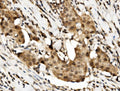 Anti-Human RBM45 Antibody