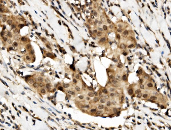 Anti-Human RBM45 Antibody