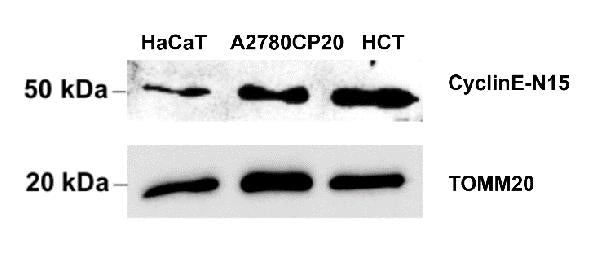 Anti-Human CCNE1 Antibody
