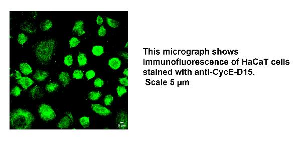 Anti-Human CCNE1 Antibody