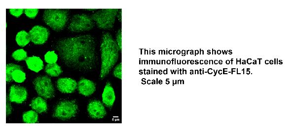 Anti-Human CCNE1 Antibody