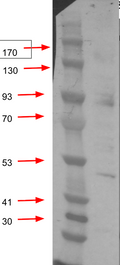 Anti-Purple sea urchin LOC581356 Antibody