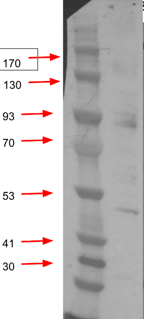 Anti-Purple sea urchin LOC581356 Antibody
