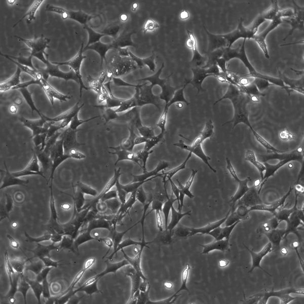 E11 cell