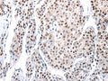 AQP2 Polyclonal Antibody – Figure 1 of 3