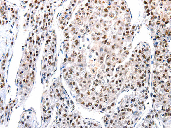 AQP2 Polyclonal Antibody – Figure 1 of 3