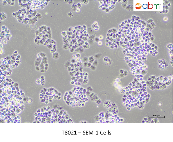 SEM-1 Cells – Figure 1 of 1