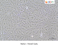 THJ16T Cells – Figure 1 of 1