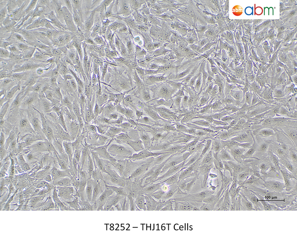 THJ16T Cells – Figure 1 of 1