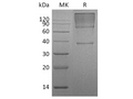 Recombinant Human Glypican 3/GPC3 Protein (His Tag) – Figure 1 of 3