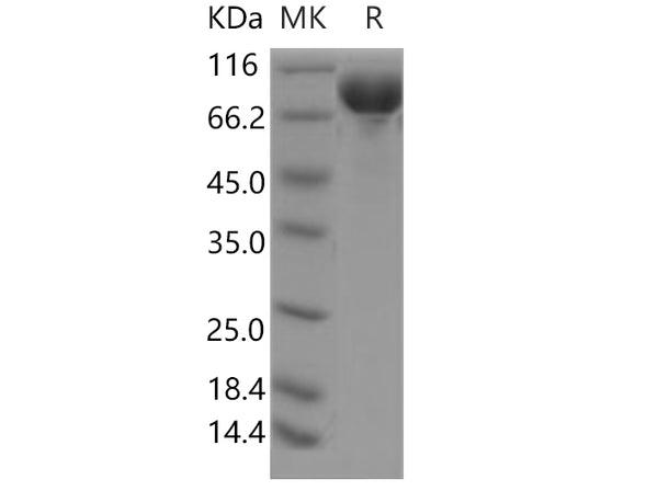 Recombinant Human DCBLD2/ESDN Protein (aa 1-482, His Tag) – Figure 1 of 2