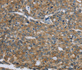 CK-5 Polyclonal Antibody – Figure 1 of 3