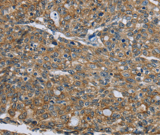 CK-5 Polyclonal Antibody – Figure 1 of 3