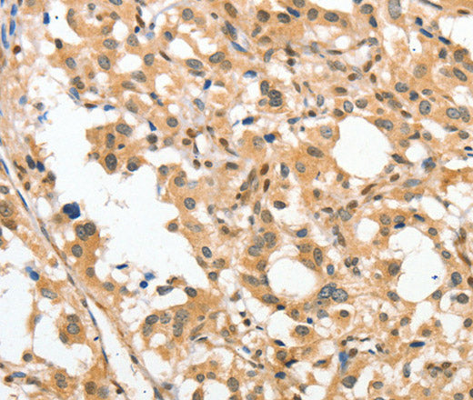 APTX Polyclonal Antibody – Figure 1 of 3