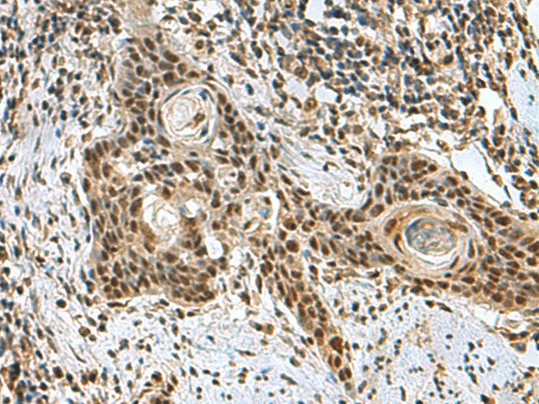 PRPF40A Polyclonal Antibody – Figure 1 of 3