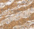 CD22 Polyclonal Antibody – Figure 1 of 3